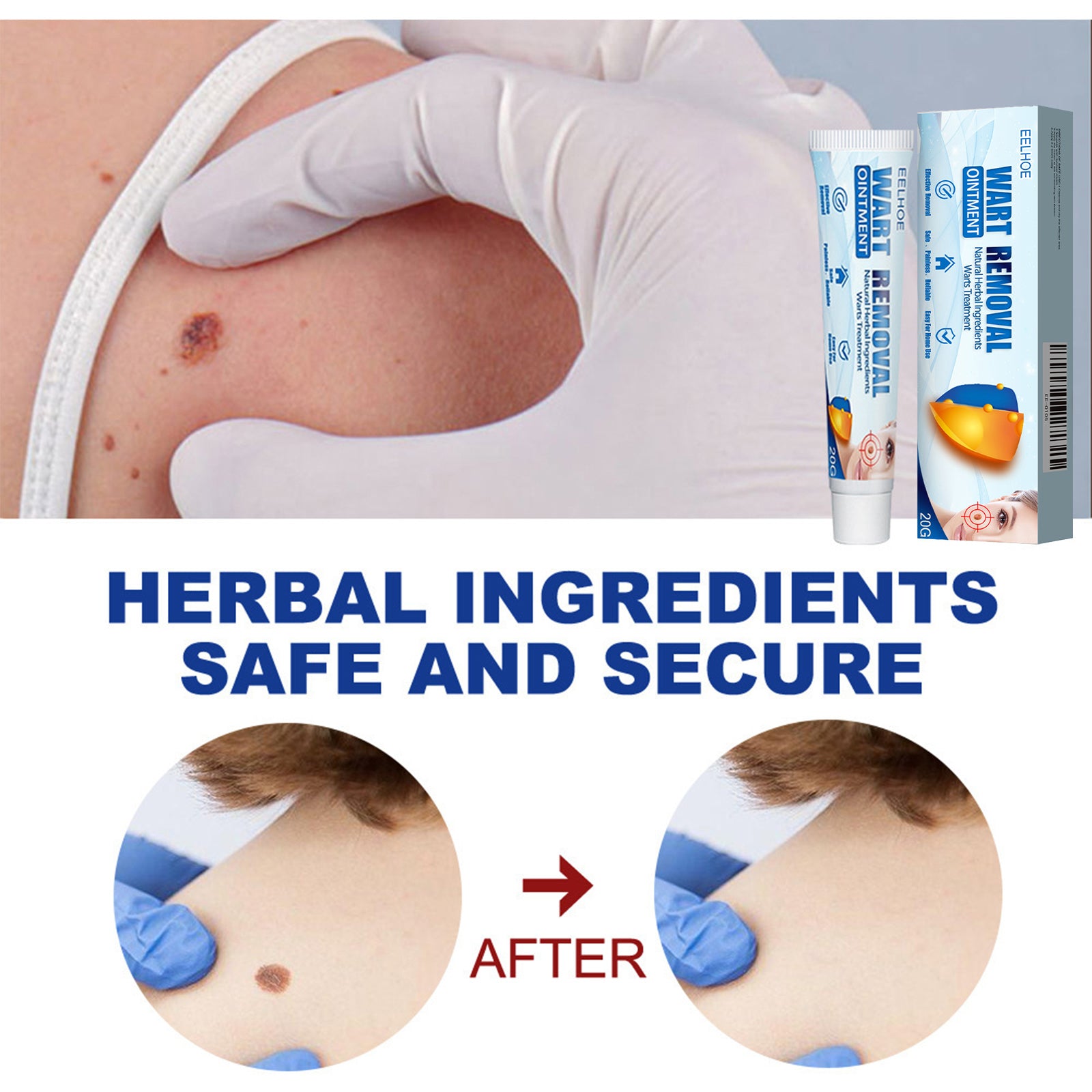 Keyu Cream Clean Skin Repair Care Body Face Remove